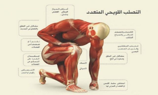 التصلب المتعدد.. 25 ألف مصرى مصاب به والعدد يرتفع إلى 60 ألفًا