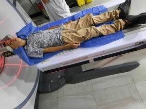 والدة طفل مصاب بمتلازمة تريتشر كولينز تطلب مساعدة لبناء وجهه من جديد