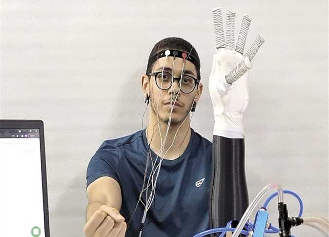 لذوي الإعاقة الحركية .. طلاب الهندسة بالجامعة البريطانية يبتكرون طرفا صناعي يعمل بإشارات المخ
